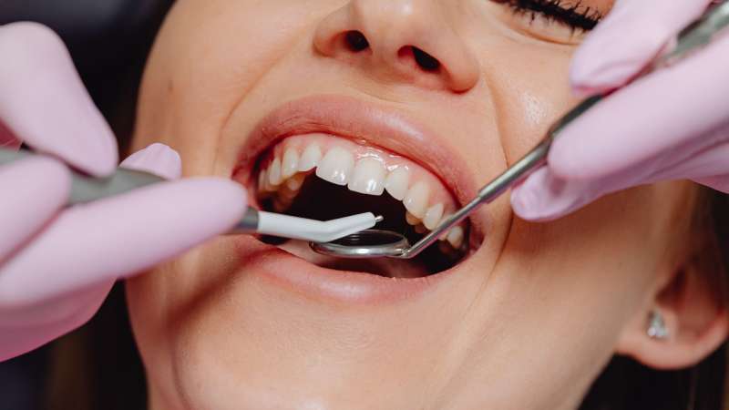 How to Find the Best Oral Surgeon for You